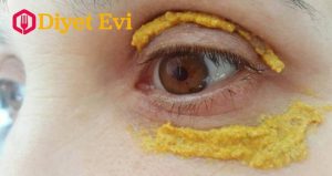 Zerdeçalın baharat dünyasında en faydalı bitki olduğunu söyleyebiliriz. Zerdeçal anti-ageing ( yaşlanma karşıtı ) bileşenleri sayesinde hücre yenileyici bir etken yapıya sahiptir. Ayrıca anti-oksidan ve iltahap giderici etkisi de bulunmaktadır. Ülkemizde, özellikle Anadolu topraklarında bir çok yemek yapımında özel madde olarak kullanılan zerdeçal kanserle mücadelede , ağrılı yaralarda ağrı kesici olarak oldukça faydalıdır . Zerdeçalın En Önemli Sağlık Faydalarını madde madde sıraladık... Yazının devamını okumak için fotoğrafın üzerine tıklayın