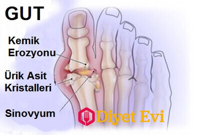 Lütfen bu haberi daha fazla insana ulaştırmak için sosyal medya hesaplarınızdan paylaşmayı ihmal etmeyin. Sağlıklı günler dileriz.
