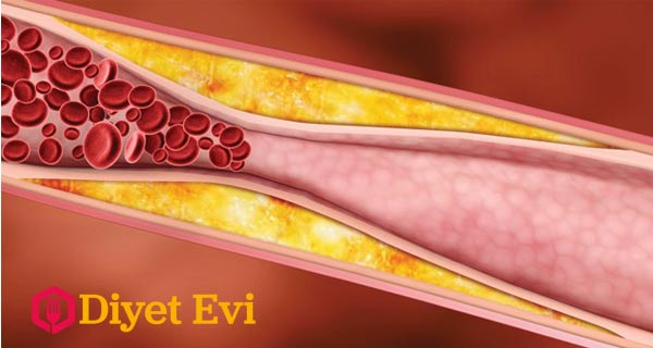 Bu içeceğin temel maddesi kabak. Kabakta bulunan lifli hücreler ve sahip olduğu zengin A vitamini, yüksek miktarda demir, çinko gibi minaraller kan şekeri ve kolesterol üzerinde oldukça etkilidir. Çiğ kabaktan elde edeceğimiz içecek bizim sağlıklı günlere kavuşmamızda ki en önemli dostumuz olacaktır. Şimdi bu kabaktan yapılan içeceğin malzemelerini okumak için için görsele tıklayarak 3. fotoğrafa geçin.
