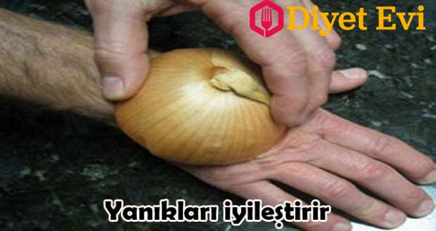 3- Soğan Yanıkları iyileştirir: Yemek yapanların her ne kadar dikkat ederse etsin malesef mutfak kazası yaşamaması mümkün değildir. Yanıklara karşı pratik ve etkili bir çözüm yarım soğanı yanıkların üzerine koymaktır. Eliniz yandığında soğanı ortadan ikiye kesin ve elinizin üzerine bastırın. Acısını kısa sürede dindirecektir. Tıkalı burnu açma yöntemi için resme tıklayın