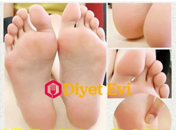 1 hafta içinde ayaklarınızdaki ölü deriler, parmak kenarlarındaki deriler yok olacak, topuk çatlakları giderek küçülecek, sağlıklı ayaklara kavuşacaksınız.