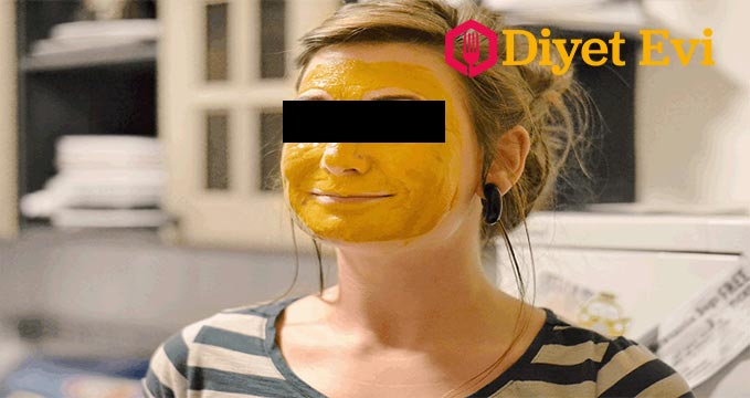 Cildinizi sağlıklı hale getirecek mucize: Eğer bu güçlü baharatı kullanırsanız cilt pigmentlerinizi yenileyerek sizi gençleştirir. Tabi ki düzenli kullanımda ve dozajını ayarladığınız taktirde. Ve parıl parıl bir cilt elde etmenin tarifi.. -Ev yapımı Zerdeçal Macunu Tarifi- Sadece yarım çay kaşığı zencefil , Limon Suyu, 1 Çay kaşığı un, 1/2 çay kaşığı domates suyu. Bütün karışımı macun kıvamına gelene kadar karıştırın. Ardından Göz çevrenize halkalar şeklinde sürün. Bu şekilde 10 dakika bekletin. üzerini kapamayın. Süre dolduktan sonra soğuk suyla durulayın. Böylece gözlerinizin altındaki mor halkalardan kurtulmuş olacaksınız. Kalbe faydalarını okumak için görsele tıklayın ve galeriye devam edin.