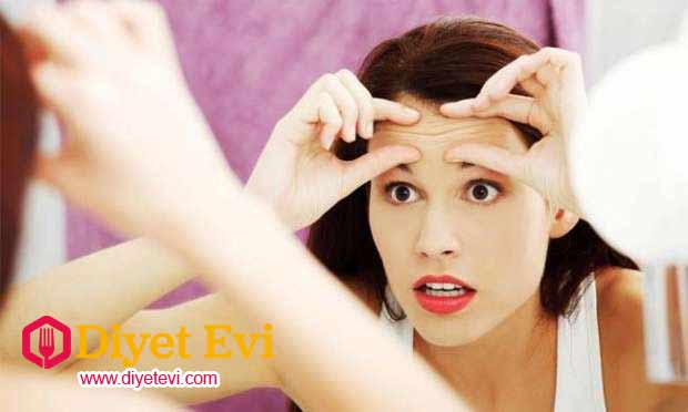 Malzemeler: 2 yemek kaşığı kaymak 1 adet elma püresi.... 1 adet elmayı rendeleyelim ve blendır ile püre haline getirelim. Hazırladığımız elma püresinin içerisine 1 yemek kaşığı kaymak ilave ederek karıştıralım. Sağlıklı ve parlak bir cilde sahip olmanıza imkan tanıyacak olan bu özel maske tarifi aynı zaman da cilt üzerinde ki lekelerin de giderilmesine yardımcı olmaktadır. Kaynak: www.diyetevi.com sitesine aittir aktif link verilmeden ve izin alınmadan paylaşılamaz.