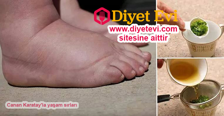 Bacaklardan ödem attırıcı doğal çay