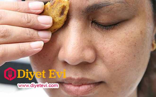 Muz cilt sağlığı için harika bir meyvedir, içinde siğilleri yok etmeye yarayan proteolitik enzim barındırır. İhtiyacınız olanlar: 1 adet muz kabuğu Ne Yapacağım: Bir kaşıkla muzun içini çıkartın. Elinizde kalan kabuğu doğrudan siğile uygulayın ve daha sonra siğilin vücudunuzun başka bölgelerine yayılmaması için ellerinizi yıkayın. İstediğiniz sonucu görene kadar bu uygulamayı tekrarlayın. Fesleğen tedavisi için görsele tıklayın ve 5. fotoğrafa geçin.