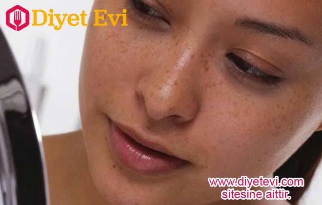 Cilt rengindeki bu renk değişimleri ve kahverengi noktalar genellikle yaş almaya bağlı olarak oluşsa da deri hücrelerindeki melanin birikiminin artması neticesinde ortaya çıkmaktadır. 3 farklı çeşidi olan bu lekeler 1- yaşlılık belirtileri 2- karaciğer rahatsızlıkları 3- güneş lekeleri olarak ayrılır. Bu lekeler lazer tedavileri , pahalı kozmetik ürünlerinin cilt derisini eşitleme özelliği gibi yüksek paralar harcayarak giderilirken, vereceğimiz doğal maydanoz toniği ile bu sorunu çözmek sizin elinizde olacak. Peki nasıl….Öğrenmek için görsele tıklayın ve 3. fotoğrafa geçin.