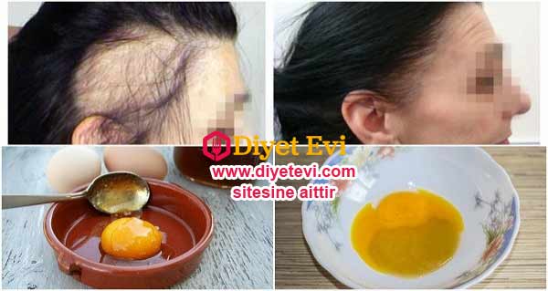 Hint yağı: saç kaybını tedavi etmektedir. Bu güçlü anti-mantar ve anti-bakteriyel özelliği ile saçlarınızın canlanmasını sağlayacaktır. Ayrıca kafanızdaki kepeklenmeyi de engelleyecektir. Bal: Balda mantar ve mikrop kırıcı özelliğe sahiptir. Güçlü bir antioksidandır. Yumurta Sarısı: Yumurta sarısı aminoasitler ve saçlar için harika bir besin kaynağı olan proteinler içerir. Ayrıca daha hızlı ve sağlıklı saç büyümesi için gerekli olan bir çok besin maddesini de içerir. Sarısında bulunan biotin saç köklerinin yenilenmesine yardımcı olur.