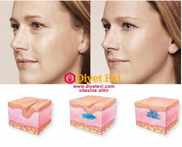 Bu göz altı morlukları hem görünüşümüzü etkilemekte hem de sağlığımız açısından zorluklar yaşamamıza sebebiyet vermektedir. Kendimizi daha iyi hissedeceğimiz bir görüntü için bu morluklardan kurtulmak herkesin aklından geçer. Bu morluklardan kurtulmak için profesyonel yöntemlere başvurulsa da daha çok doğal ve basit kişisel yöntemlerle de kolaylıkla çözülmektedir. Şimdi bu doğal çözüm için maske önerileri vereceğiz. Devam etmek için görsele tıklayın ve 3. fotoğrafa geçin.