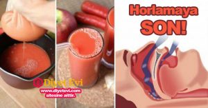 Horlamayı kesen ve uyku apnesine iyi gelen doğal tedavi yöntemi: Horlama rahatsız edicidir ve bir hastalığın belirtisi olabilir. Eğer horluyorsanız bu tedaviyi deneyebilirsiniz. Hava kanallarınızın açılmasına yardımcı olacaktır.Horlama, bir kişi uyurken çıkan yüksek nefes alıp verme sesidir. Horlama en can sıkıcı uyku rahatsızlıklarından birisidir çünkü eşinizin veya sizinle aynı evde yaşayan diğer kişilerin de uyumasını engelleyebilir.Çoğu horlama vakası orta şiddette ve dönem dönem olsa da bazı kişilerde horlama şiddeti, bir uzmana danışıp horlamanın uyku apnesi nedeniyle olup olmadığının teşhis edilmesini gerektirebilir. Uyku apnesi, üst solunum yolunun tekrarlayan bir biçimde tıkanması veya çökmesi sonucu ortaya çıkan bir tür nefes alma zorluğudur.Nefes almada, yaklaşık 10 saniye civarında süren bir bozulmaya neden olur ve oksijen seviyelerinde azalma yaşanır.Nefes alış veriş, daralmış hava alanından hava geçmesi sonucu ortay çıkan yüksek bir horlama sesiyle normale döner.Uyku apnesine ek olarak, horlamaya yatkınlığı arttıran başka etkenler de vardır.Obezite, burun tıkanıklığı ve yatış pozisyonunuz horlamaya neden olabilir. Bu yazımızda sizlerle horlama sorunuyla ilaç almadan baş etmenize yardımcı olacak bazı çözümler paylaşacağız. Horlamanın doğal tedavisi için gerekenler ve karışımın malzemelerini okumak için görsele tıklayın ve 2. fotoğrafa geçin.