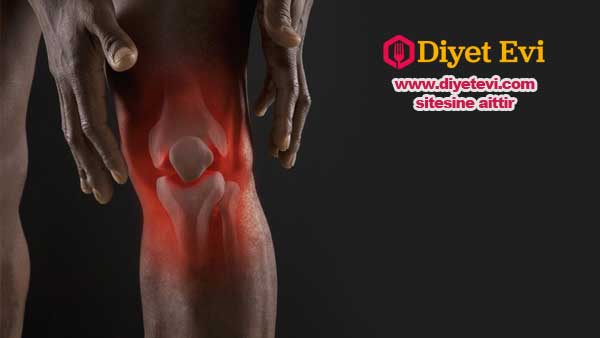 4- Elma sirkesi: Elma sirkesi alkalize yapısı ile dizlerde oluşan zararlı toksinleri etkisiz hale getirir. 2 yemek kaşığı elma sirkesini duş almadan önce dizlerinize sürüp 10 dakika boyunca bekletin. Bu süre içinde diz kolay emilen elma sirkesini emecektir. Bu 4 yöntem dizlerdeki ağrıları azaltmaya ve şişkinliği gidermeye yöneliktir. Eğer bu yöntemler işe yaramadıysa güzel bir hekime tedavi olmak gerekir. Lütfen bu haberi sosyal medya hesaplarınızda paylaşarak daha fazla insana ulaşmasını sağlayın.