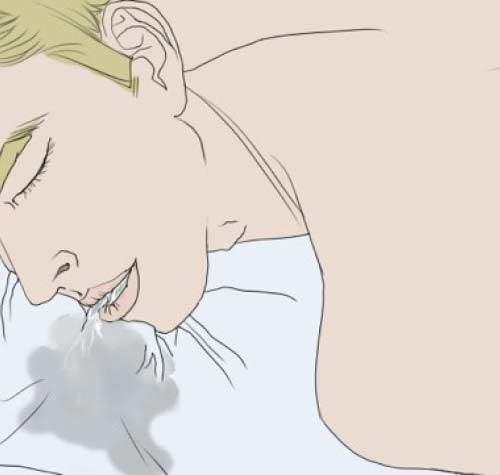 İlaçları Doktorunuza Danışın: Aldığınız ilaçların yan etkisi olarak vücudunuz aşırı derecede salya üretebilir. Şüpheli ilaçları kullandığınızda vücudunuzda bir değişiklik meydana getiriyorsa doktorunuza anlatın ve ona görünün. Burnunuzdan Nefes Alın Uyurken salya akmasının ana nedenlerinden biri ağızdan nefes almaktır. Derin Nefes Alma Egzersizleri Yapın: Ağızdan nefes almak için belli bir nedeniniz yoksa günlük rutin işlerinizin arasına derin nefes alma egzersizlerini eklemek de güzel bir fikir olabilir. Bu egzersizler doğru nefes alma alışkanlığı kazanmanıza ve stresinizi daha iyi kontrol altına almaya yardım eder. Alerjiler İçin Eğer alerjileriniz sizi burnunuzdan nefes almaya zorluyorsa OTC alerji ilaçları alın. Burun yolunuzu temiz tutmak için en iyi yöntemi öğrenmek amacıyla bir alerji uzmanına başvurabilirsiniz.