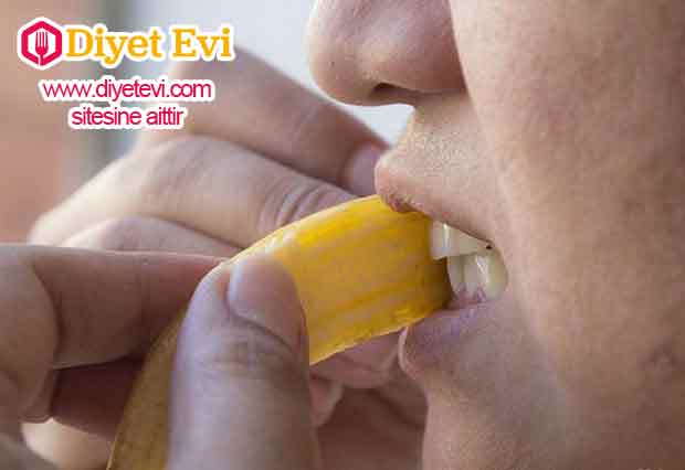 Elma sirkesi: gargarası Seyreltilmiş elma sirkesinin dişlerde inanılmaz bir etkisi olduğu söylenir. 3 ölçek su ve 1 ölçek sirkeyi karıştırıp gargara olarak kullanabilirsiniz. Muz kabuğu: Muz kabuğunun iç kısmı potasyum, manganez ve magnezyum gibi mineraller açısından oldukça zengindir. Bu mineraller diş minesi tarafından emilir ve beyazlatıcı etki gösterir. Dişlerinizi fırçaladıktan sonra muz kabuğunun içini dişlerinize sürün ve 2 dakika bekletin. Ardından iyice durulayın.