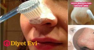 Siyah nokta temizleme maskesi nasıl yapılır İnternette gördüğünüz pek çok tarif işe yaramıyor ama bu tarif siyah noktaları yok ediyor ve bebek gibi bir cilde sahip oluyorsunuz. Siyah noktalar aslında hepimizin cildinde var fakat yanlış cilt bakımı, yağlı cilt sorunu ve yeteri kadar temizlememek gibi nedenler ile gözenekler tıkanır ve siyah noktalar oluşur. Bu yazımızda size siyah noktaları tertemiz yapan oldukça etkili ev yapımı çözümden bahsedeceğiz. Hemen tarife geçmek için görsele tıklayın ve malzemelerin anlatıldığı 2. fotoğrafa geçin.