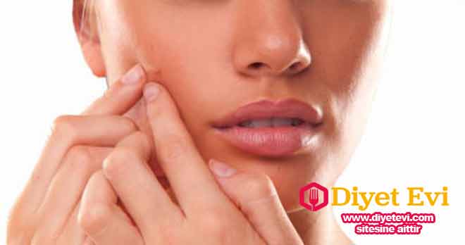 Siyah nokta maskesi yapılışı: 3 adımdan oluşan bu uygulamanın ilk adımına ciltteki yağ oranını azaltmak için diş macununa tuz koyarak sorunlu bölgelerimize hafifçe masaj yaparak sürelim. Daha sonra küçük bir parça steril gazlı beze sıçak su yada papatya suyunu sürelim ve sorunlu bölgemize bastıralım. yaklaşık 25 dk kadar bu şekilde ıslak bez cildimizde kalmalı. Bu işlem yağ oranı azaltılmış sorunlu bölgenin yumuşayarak genişlemesini ve gözeneklerin açılmasını sağlayacak. Üçüncü ve en önemli kısıma geçmek için görsele tıklayın ve son fotoğrafa geçin.