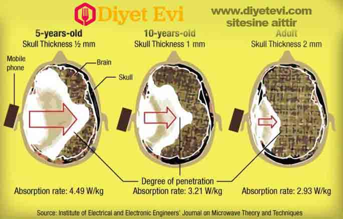 Çocuklar telefondan kat kat daha çok etkilenir Çocukların daha çok etkilenmesinin diğer bir nedeni, kafataslarının yetişkinlere nazaran çok daha ince olması. Bu nedenle radyasyon, beyinlerine daha kolay yayılabiliyor. Radyasyonun yoğun etkisinin en çarpıcı nedeni ise cep telefonu radyasyonu ile çocuk vücudunun, ‘rezonans’ adı verilen bir etkileşime girmesi. Rezonans olayı, çocukların ortalama boyu ile cep telefonu radyasyonunun dalga boyu arasındaki uyumdan kaynaklanır. Çocukların vücudu cep telefonu radyasyonunu, aynen bir antenin televizyon yayınlarını alması gibi üzerinde toplar. Bu da çocukların yetişkinlere nazaran kat kat daha fazla radyasyona maruz kalması demek. Batı’nın teknolojinin zararlarına karşı tedbir aldığını, ancak Türkiye’de böyle bir mantık hala kullanılmadığını vurguladı. Bu görselde soldaki ilk görsel 5 yasındaki birinin telefonda konuşması sırasında beyninin ne kadarının radyasyondan etkilendiğini gösteriyor. Nedereyse beyninin tamamı. Ortadaki görselde 10 yaşındaki bir çocugun etkilendiği alan yarı yarıya düşmüş. En sağda ise yetişkin bir bireyin telefondan aldığı zararlı ışınlar gösterilmiş. Ne yapmamız gerekir öğrenmek için görsele tıklayın ve 4. fotoğrafa geçin.