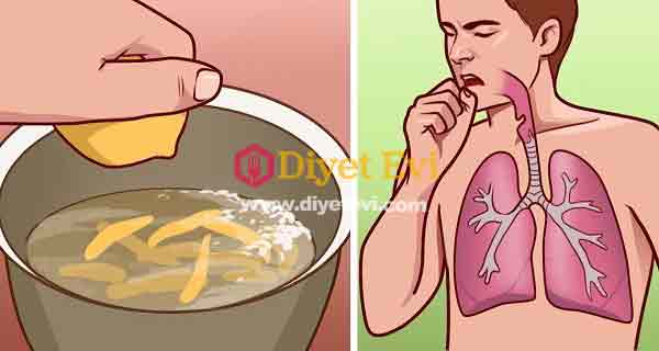 Ağrılı öksürük ve bronşit için doğal tedavi yöntemi