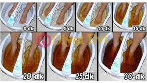 Ayak detoksu ile vücuttan zehirli toksinleri atmak