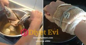 Zencefilli Su ile Romatizma ve Artrit Tedavisi : Romatizma ve artrit tedavisi için kullanın Zencefil Su Kaplama Yıllarca zencefil soğuk algınlığı ve grip tedavisinde kullanıldı. Ayrıca, romatizma, siyatik, tromboz, artrit ve diğer benzer sağlık sorunları için etkili bir ilaç olduğu uzmanlarca kanıtlanmıştır. Artrit ve romatizma söz konusu olduğunda, zencefil ve su kaplaması yapmanın iki yöntemi var: İlki zencefil su yöntemi Hazırlanışı : Yarım çorba kaşığı zencefili 150 ml sıcak su ile karıştırın ve soğumaya bırakın. Bunu günde iki kez bir ay boyunca tüketin. İlkinci yöntem için görsele tıklayın ve 2. Fotoğrafa geçin.