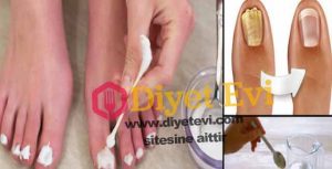 Sirke ile ayak mantarı doğal tedavisi nasıl yapılır : Hemen hemen hepimizin ortak sorunudur, Ayak mantarı nasıl iyileşir, ayak mantarı nasıl geçer, ayak mantarından kurtulma yolları, ayak mantarı bitkisel tedavi, ayak mantarı üzüm sirkesi ile geçer mi? Eminiz ki bunlardan en az 2-3 tanesini aradınız ve cevap bulmaya çalıştınız. İşte size en etkili ve kısa sürede Sirke ile ayak mantarı doğal tedavisi nasıl yapılır sorusuna cevap. Okumaya devam etmek için görsele tıkla.