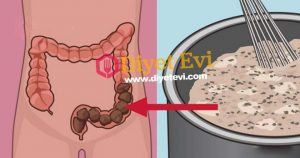 Bağırsak temizleme diyeti ile 3 haftada 10 kilo verin Bağırsak temizleme diyeti ile 3 haftada 10 kilo verin: Unutmayın vücudunuzun sindiremediği bütün gıdalar kalın bağırsakta mukus şeklinde birikir ve orada çok sayıda toksin oluşumuna sebep olur. Bağırsaklarda biriken toksin de gün içinde size yorgunluk, baş ağrısı, kilo ve enerji düşüklüğü olarak geri gelir. Sabahları yorgun kalkmak, baş ağrısı ile günü geçirmek, hiç birşey yemediğiniz halde kilo almanız, gün daha bitmeden enerjiniz tükenmiş gibi hissetmeniz hep bağırsaklarda biriken toksinlerden dolayı oluyor. Neyse ki bütün bu şikayetlerinizi son bulduracak; yüksek miktarda lifli besin içeren yiyeceklerden oluşan diyet ile bağırsaklarınızı temizleyen, toksinleri attıran ve 3 hafta gibi kısa bir sürede 10 kiloya kadar zayıflamanızı sağlayan bir diyetimiz var. Malzemeler için görsele tıklayın ve 2. fotoğrafa geçin.