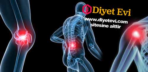 Eklem ağrıları neden olur: Eklem ağrıları romatoid artrit sebebiyle ya da fazla kiloya bağlı olarak aşınma sebebiyle oluşur genellikle belli bir yaştan sonra daha sık görülen şikayettir. Özellikle diz acısı çok sık söylenen şikayetlerdir. Fakat size vereceğimiz karışım tarifi ile Diz ağrısı ve eklem ağrısını şikayetleriniz 3 günde son bulacaktır. Bu karışımı her gün tükettiğinizde ne olacak: 1-Bu karışım iltahab ile savaşır ve vücuttaki iltahabı kurutur. 2-Ağrılarınız durdurur. 3-Eklemi çevreleyen bağ ve tendonları güçlendirir. 4- Trigliserid ve kolesterol seviyesini dengeler. 5-Magnezyum ve silikon gibi minaraller bakımından zengindir ve C vitamini - Bromelain eksikliğini giderir. Gerekli malzemeler için görsele tıklayın ve 3. fotoğrafa geçin.