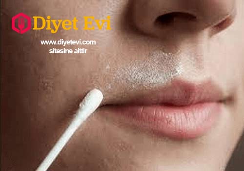 Yulaf ezmesinin su dengesini sağlama özelliği kuruluk ile savaşır, cildin pH dengesini sağlar ve doğal bir eksfoliant görevi görüp cildimizi ölü hücrelerden arındırır. Limon suyu cildin arınmasına yardım eder, derin bir temizlik sağlarken istenmeyen tüylerin uzaması ile savaşır. Son olarak, bal; zengin antioksidan ve vitamin içeriği ile doğal bir nemlendiricidir, bu da onu cilt bakımı ürünlerinde kullanılan popüler bir madde haline getirmektedir. Doğal tüy dökücü krem nasıl yapılır? Bu doğal tedavinin hazırlanması çok kolaydır ve çok etkili olduğu için yüzdeki tüylerden kurtulma yöntemleri bakımından gün geçtikçe bilinirliği artmaktadır. İçindekiler • 2 yemek kaşığı saf bal • 2 yemek kaşığı limon suyu • 1 yemek kaşığı organik yulaf ezmesi Yapılışına geçmek için tıklayın ve 2. fotoğrafa geçin.