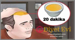 Saç çıkartan soğan sarımsak karışımı nasıl hazırlanır - Soğanlı Saç Uzatma Maskesi Tarifi: Soğanın faydası her geçen gün daha da önem taşımaya başladı. yemeklerde antibiyotik olarak faydası vurgulandıkça daha fazla kullanılmaya başladı ve artık saçlar için de çok faydalı olduğu bilinmekte. Bu haberde sizler için soğanın saçlara faydası ve Soğanlı Saç Uzatma Maskesi Tarifi anlatacağız. Okumaya devam etmek için görsele tıklayın.