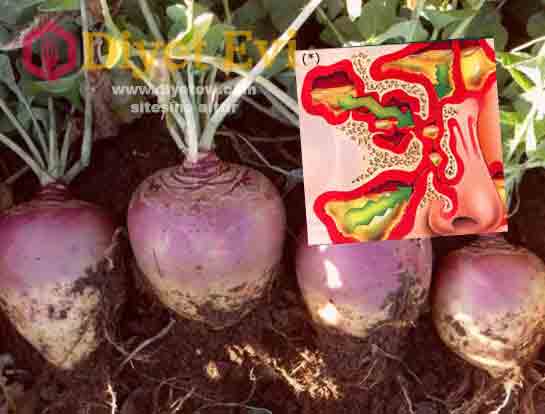 Yaban turbu ile Migren ve sinüzit tedavisi için gerekli malzemeler ve yapılışı: 1 su bardağı beyaz sirke, yarım su bardağı kadar yer kaplayan büyüklükte yaban turbu ve 1 adet hava geçirmez cam sişe. Gerekli malzemeleri temin ettiyseniz hemen yapılışına geçelim. Yapılışı: Yaban turbunu rendeleyin, üzerine beyaz sirkeyi ekleyin ve tahta bir kaşık işe karıştırın. Ağzını iyice kapatıp hava almayacak şekilde 10 gün boyunca serin ve karanlık bir yerde bekletin. Kullanım şekli ve püf noktaları için görsele tıklayın ve 4.fotoğrafa geçin.