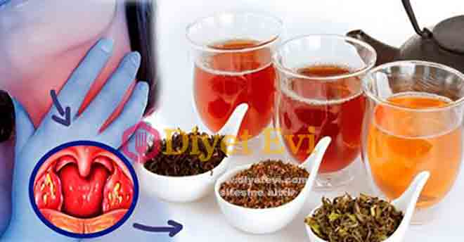 Bademcik Şişmesi için Ağrı ve iltihap giderici doğal tarif