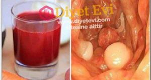 Kanser Hücrelerini 42 Günde Öldüren Reçete