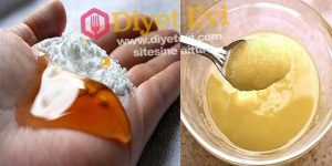 Bal ve karbonat karışımı kanser tedavisi
