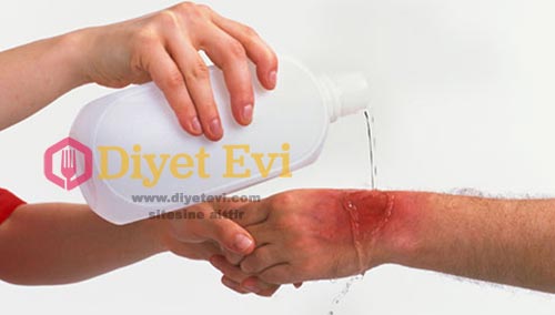 Muz çiçeğinin enfeksiyonlara faydası: Muz çiçeği, bakteri gelişimini önlemeye yardımcı olan etanol çiçeklerine sahip olduğu için, enfeksiyonu tedavi etme özelliğine sahiptir. Muz çiçeği bu sayede açık yaraları da iyileştirebilir. Aynı zamanda vücutta parazitlerin barınmasını önlemeye yardımcı olur. Görsele basarak Diyabet ve anemiye faydasını okuyabilirsiniz