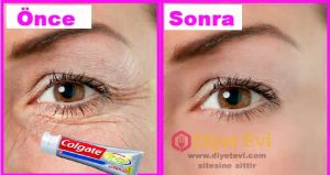 Gözaltı kırışıklıkları için diş macunu domates suyu aloevera karışımı